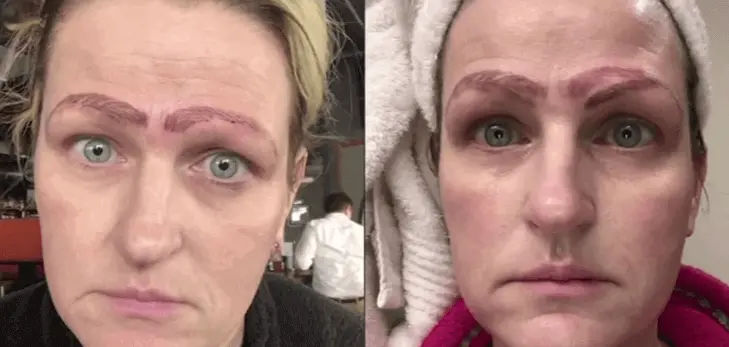 Microblading Gone Wrong: How To Avoid A Botched Eyebrows