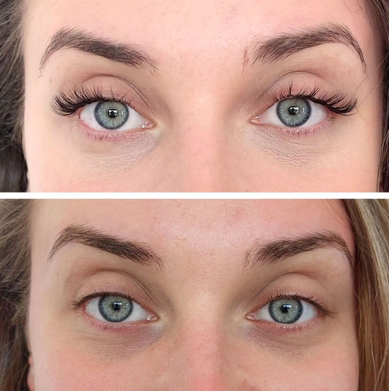 Lash Lift Vs Lash Extensions: Battle Of The Lashes