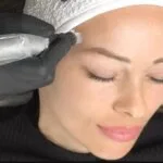 Microneedling vs. Microblading: Understanding the Differences